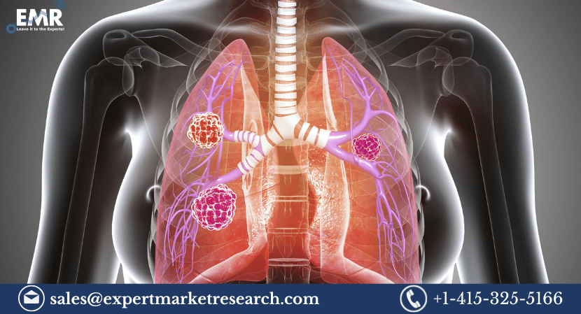 Cancer/Tumour Profiling Market