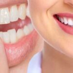 Cosmetic Dentistry