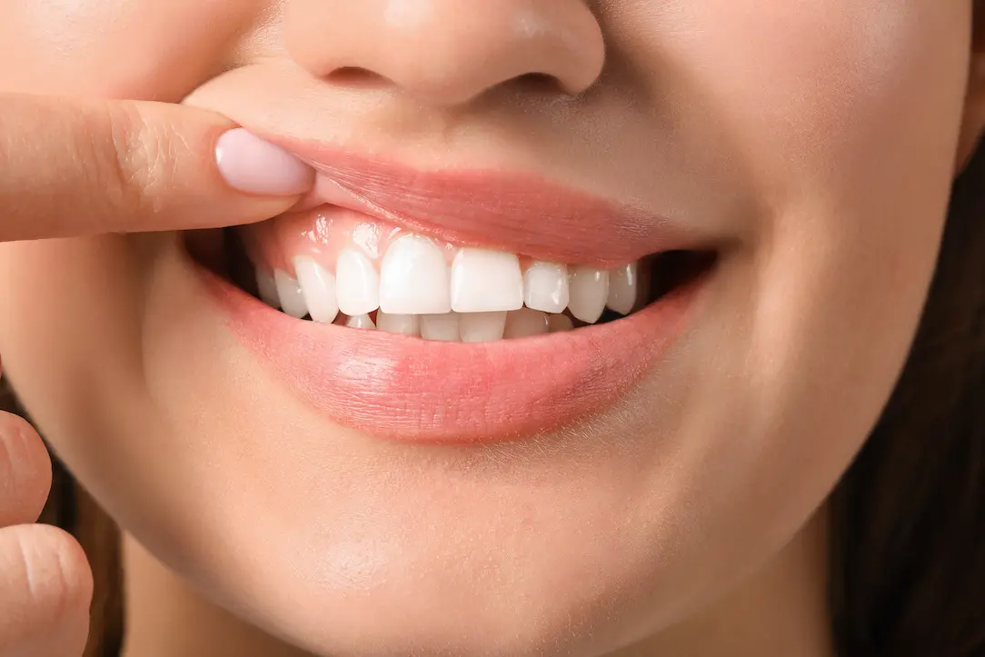 Healthy Gums, Happy Smiles: Fighting Periodontal Disease