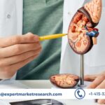 Kidney Stone Management Market Size