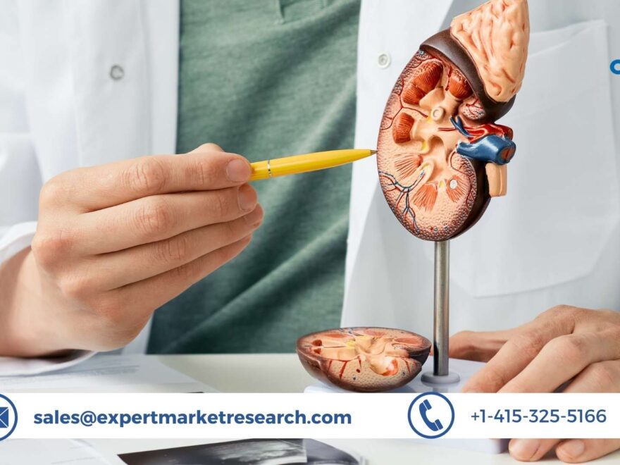 Kidney Stone Management Market Size