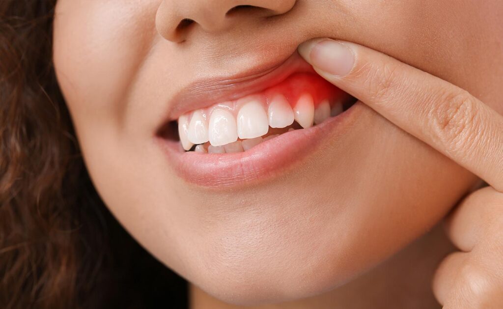 Preventing Periodontal Disease: Tips for Maintaining Healthy Gums