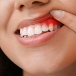 Preventing Periodontal Disease: Tips for Maintaining Healthy Gums