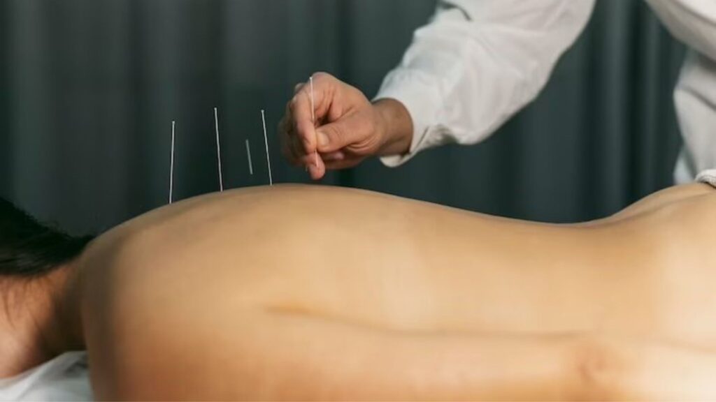 The Ancient Art of Acupuncture for Pain Relief: : The Effectiveness