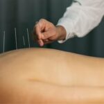 The Ancient Art of Acupuncture for Pain Relief: : The Effectiveness