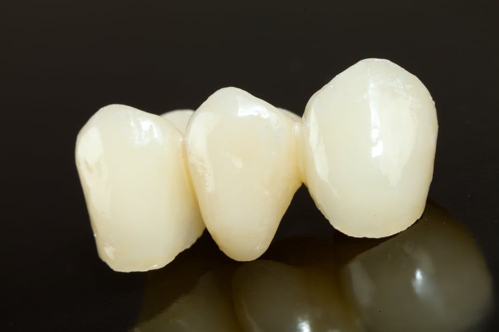 Understanding Dental Crowns in Granbury, TX