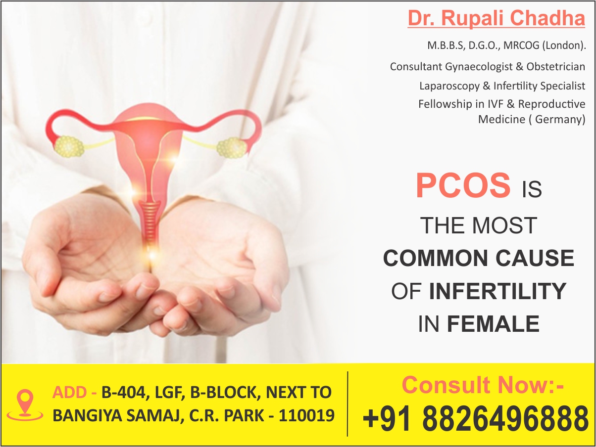 Best Gynecologist in Delhi for PCOS