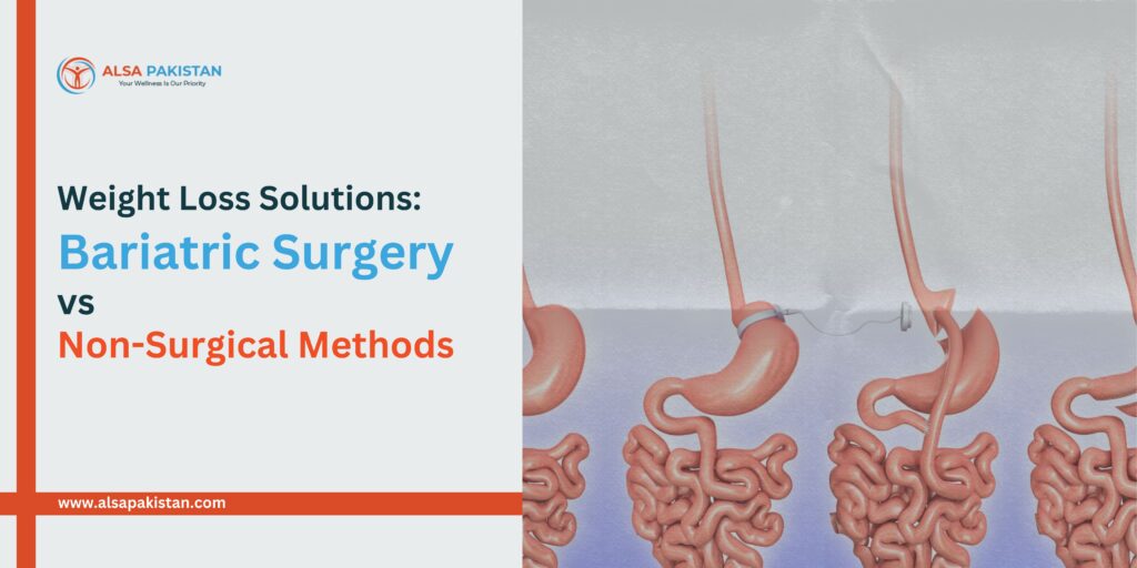 Weight Loss Solutions: Bariatric Surgery vs. Non-Surgical Methods