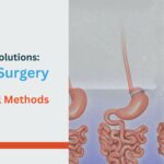 Weight Loss Solutions: Bariatric Surgery vs. Non-Surgical Methods