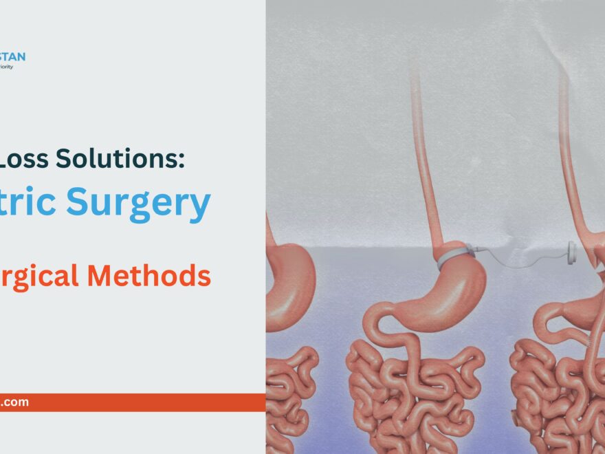 Weight Loss Solutions: Bariatric Surgery vs. Non-Surgical Methods