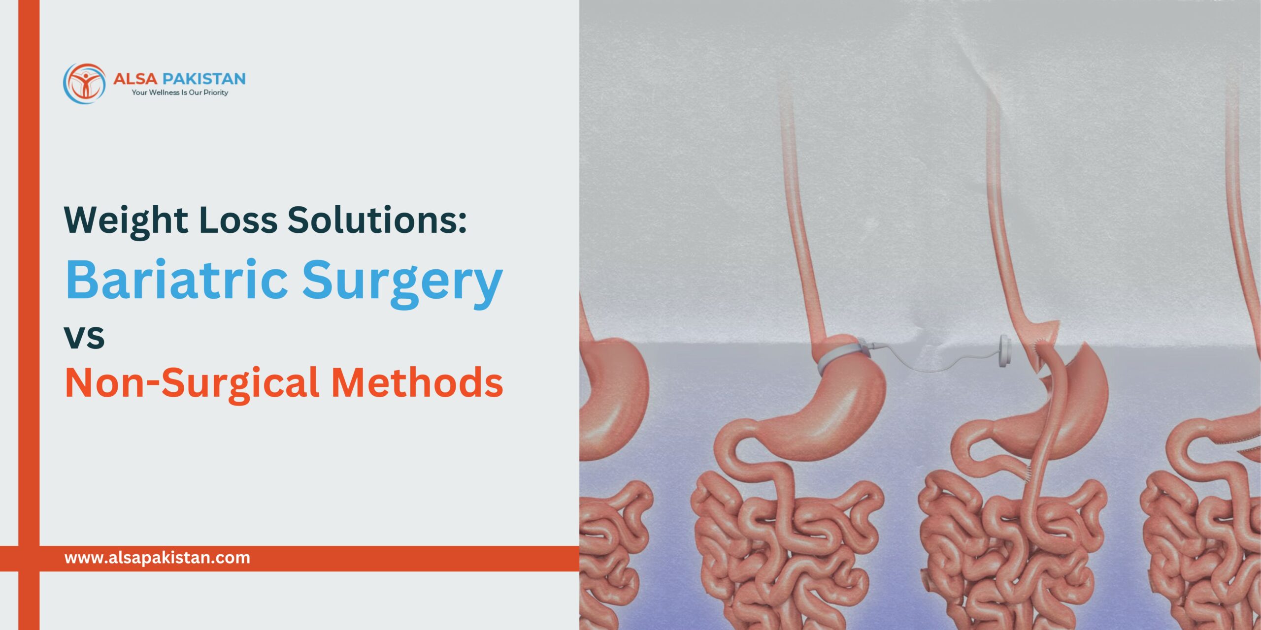 Weight Loss Solutions: Bariatric Surgery vs. Non-Surgical Methods