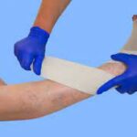 Compression Therapy Market Size 2028: Latest Trends, Demand, Growth and Forecast 2028