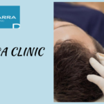 Is Hair Transplant Treatment Right for You?