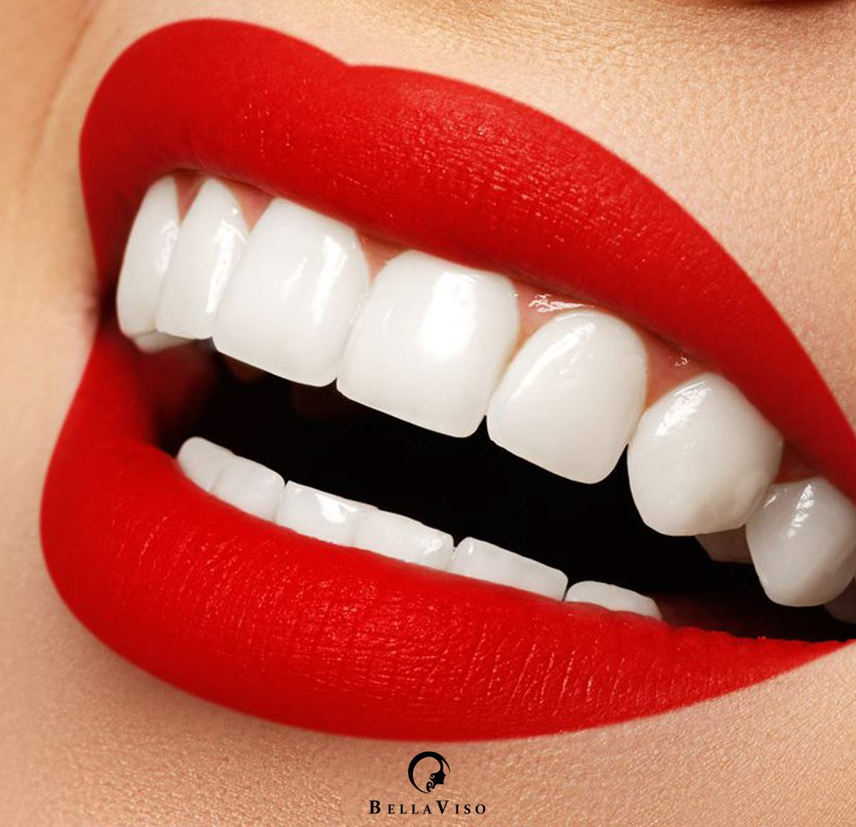 Top Rated Dental Veneers Clinic in Dubai,