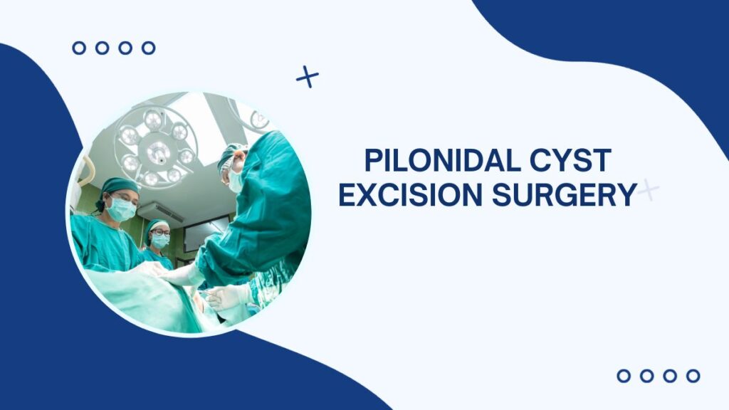 How Effective is Pilonidal Cyst Excision Surgery?