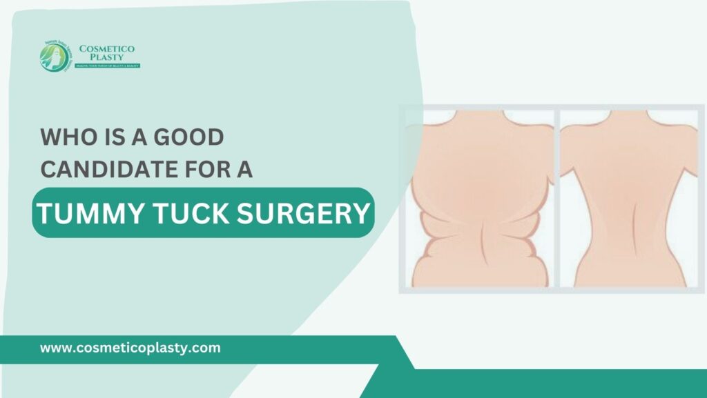 Who is a good candidate for a tummy tuck surgery