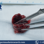 Surgical Blade Market