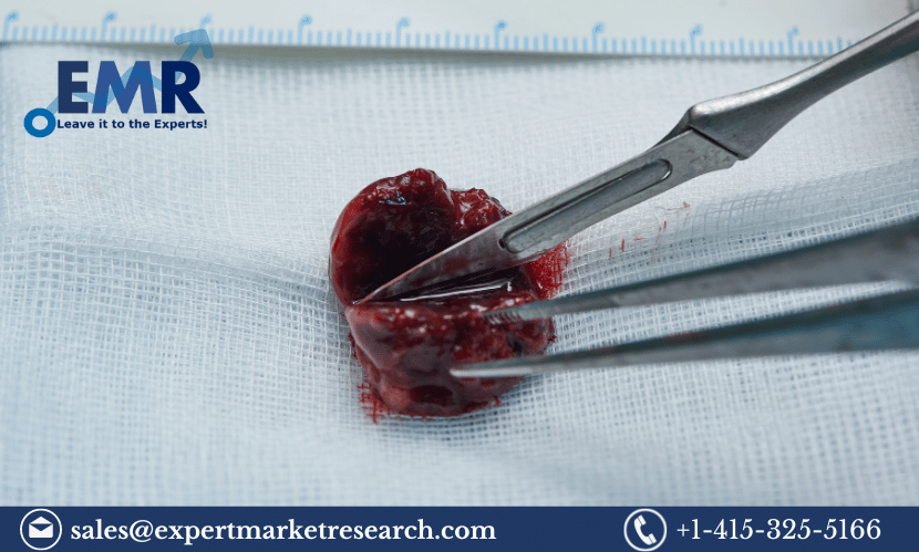 Surgical Blade Market