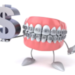 invisalign cost spearfish