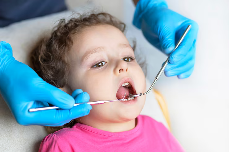 pediatric dentist rockwall tx