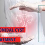 pilonidal cyst treatment