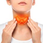 hyperthyroidism