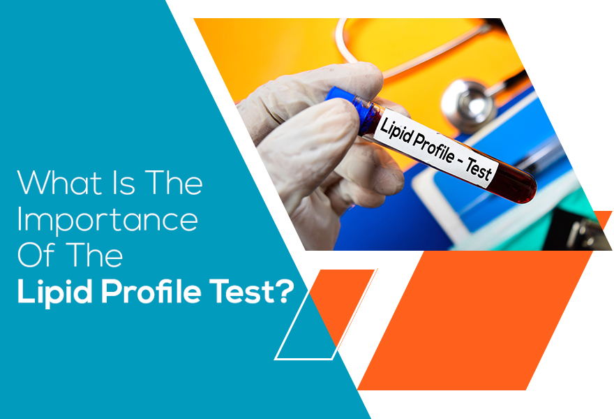 lipid profile blood test