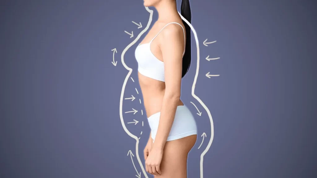 Body Contouring After Weight Loss: What to Expect