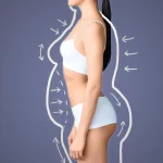 Body Contouring After Weight Loss: What to Expect