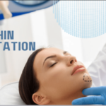 Chin Augmentation