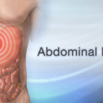 Abdominal Pain – Causes, Types & Best Treatment for It