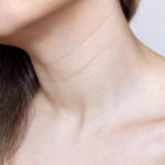 botox on neck wrinkles