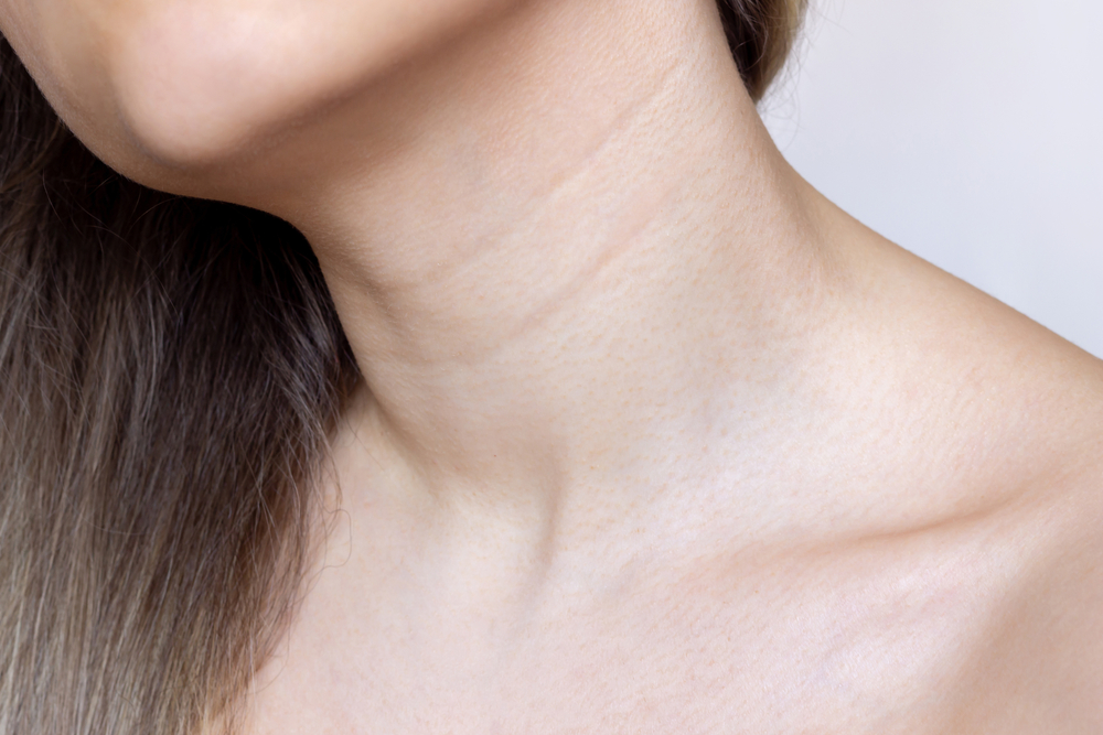 botox on neck wrinkles