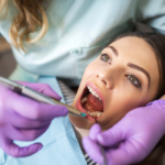 Teeth Cleaning Procedure