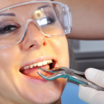 Tooth Extraction