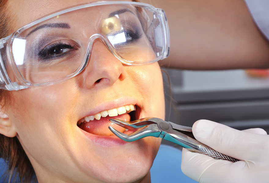 Tooth Extraction