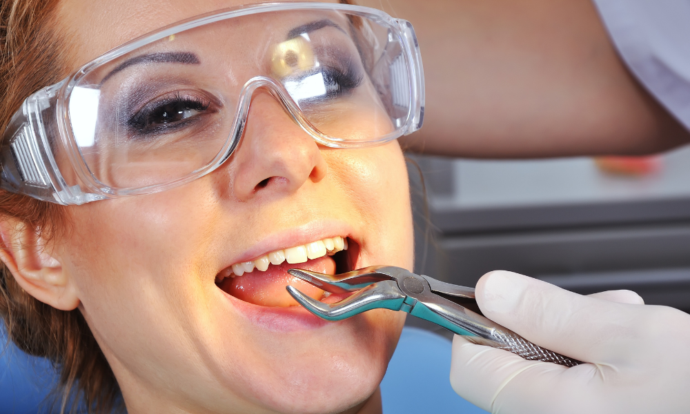 Tooth Extraction