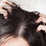 Scalp Massage Techniques for Relaxation and Itch Relief