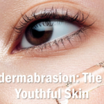 Best microdermabrasion in Montreal