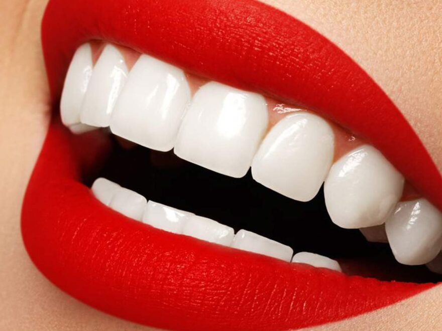 dental clinic teeth cleaning price in dubai ,