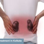 kidney stone treatment in Kolkata