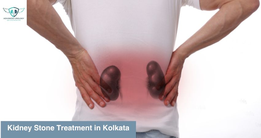 kidney stone treatment in Kolkata