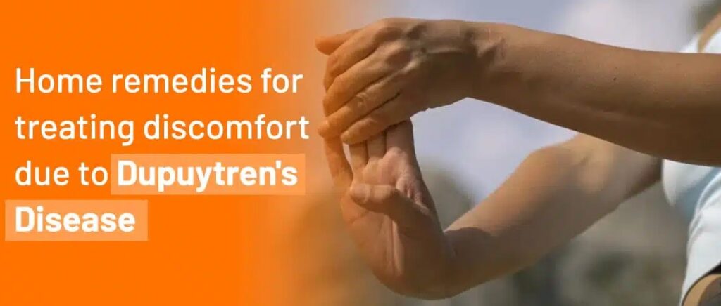 6 Home-Remedies for Dupuytren’s Contracture: A Comprehensive Guide