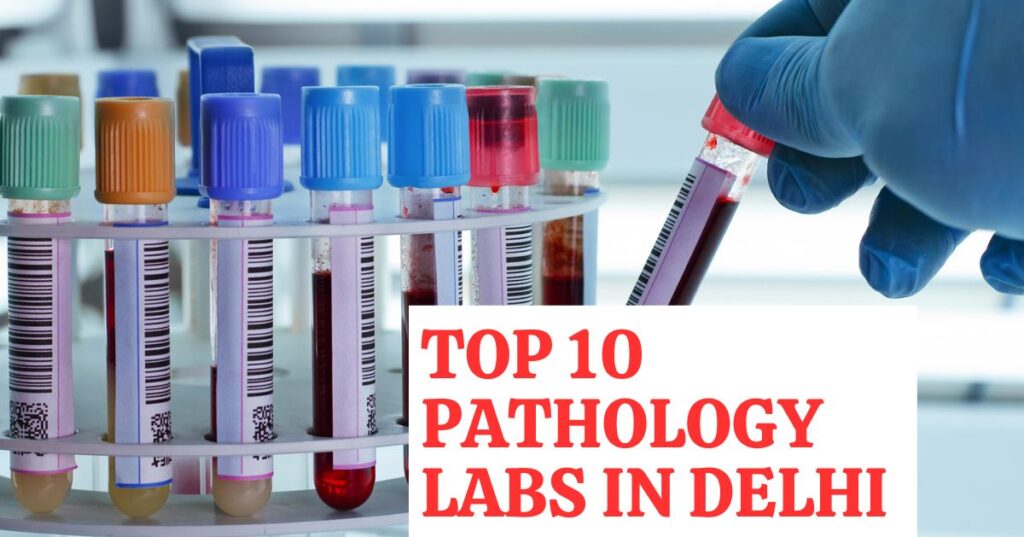 Top 10 Pathology Labs in Delhi