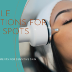 Treatments for dark spots Montreal