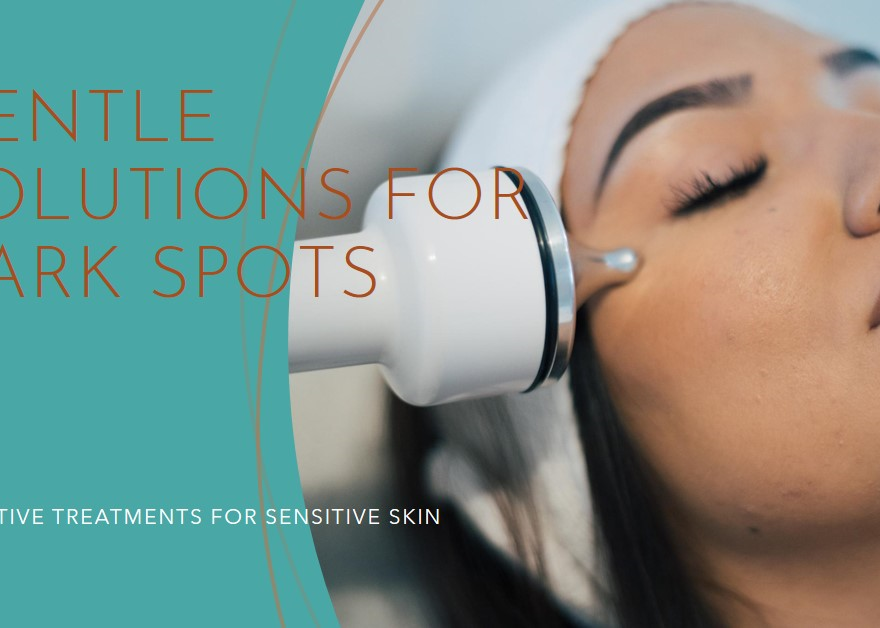 Treatments for dark spots Montreal