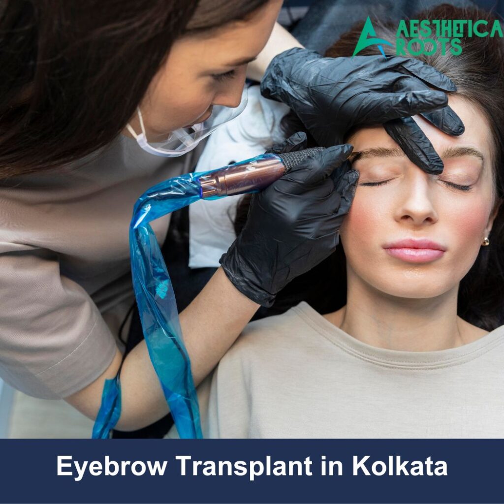 eyebrow hair transplant in kolkata