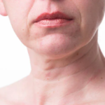 Banish Neck Wrinkles: A Comprehensive Guide to Smooth, Youthful Skin