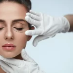 Lower eyelid surgery