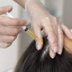 Rejuvenate Your Locks: Exploring the Marvels of PRP Hair Treatment in Pune